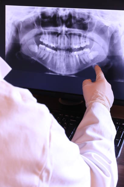 Best Emergency Dental Extractions in Cherry Hill Mall, NJ